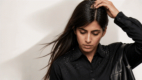 Dandruff & Itchy Scalp