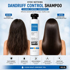 Dandruff Control Shampoo with Dead Sea Minerals & Glycolic Acid – 100ml | French Nano Tech | Rebuild, Strengthen & Smooth